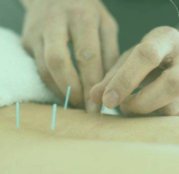 Acupuncture therapy in Surrey