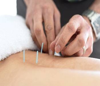 Acupuncture therapy in Vancouver
