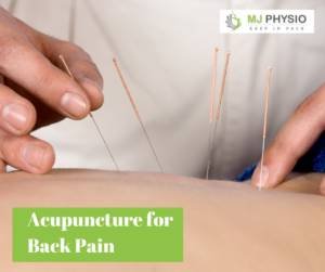 Acupuncture therapy in Vancouver