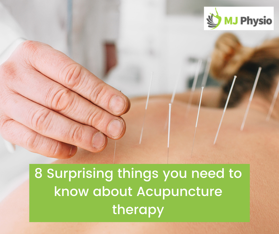 Things to know about Acupuncture therapy