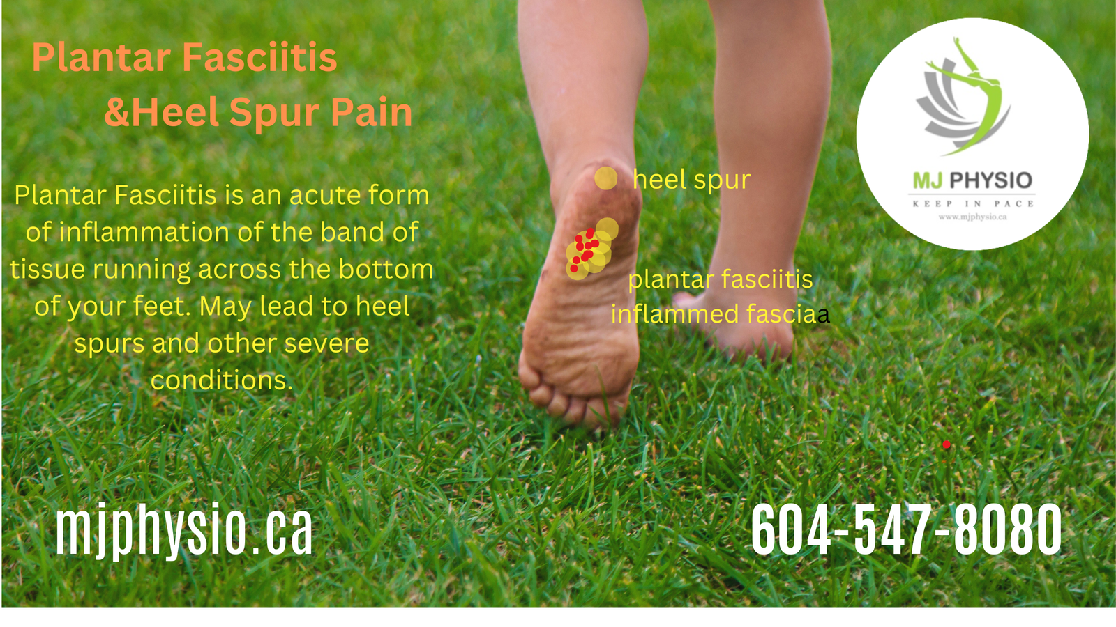 How to you know you have heel pain from calcaneal spur and plantar fasciitis.